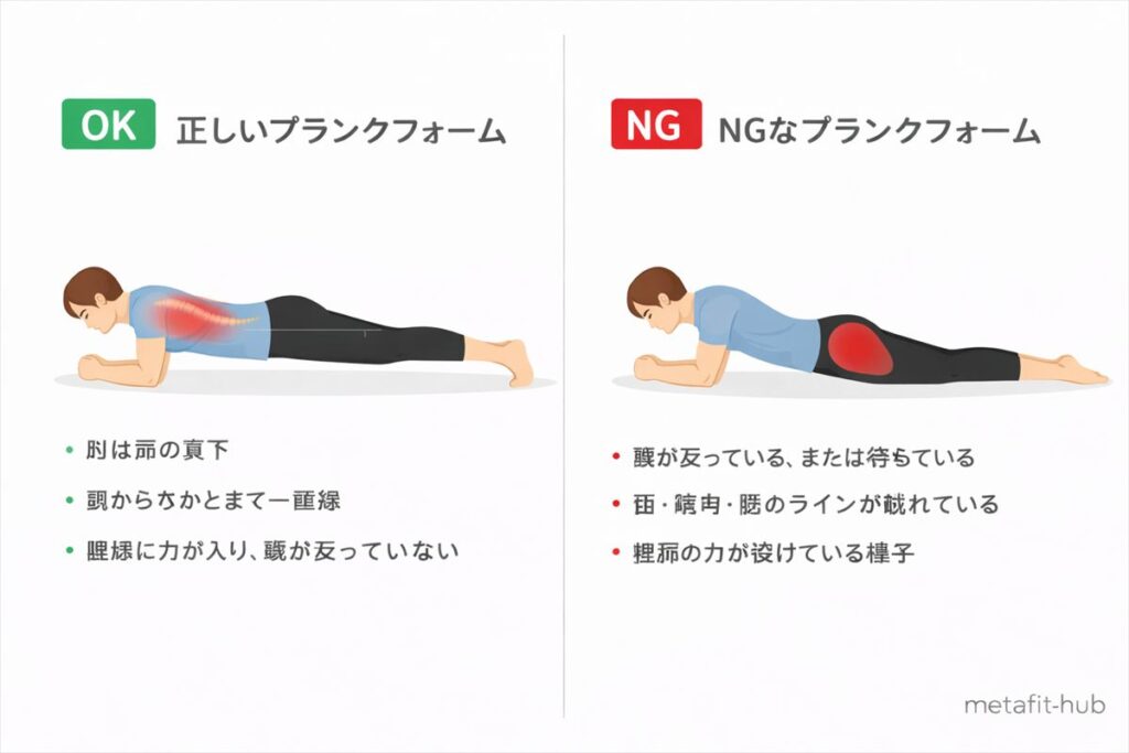 プランクの正しいフォームとNGフォームを横並びで比較した図解イラスト。正しい姿勢では肘が肩の真下にあり、頭からかかとまで一直線。NGフォームでは腰が反り、体幹の力が抜けている状態を示している。